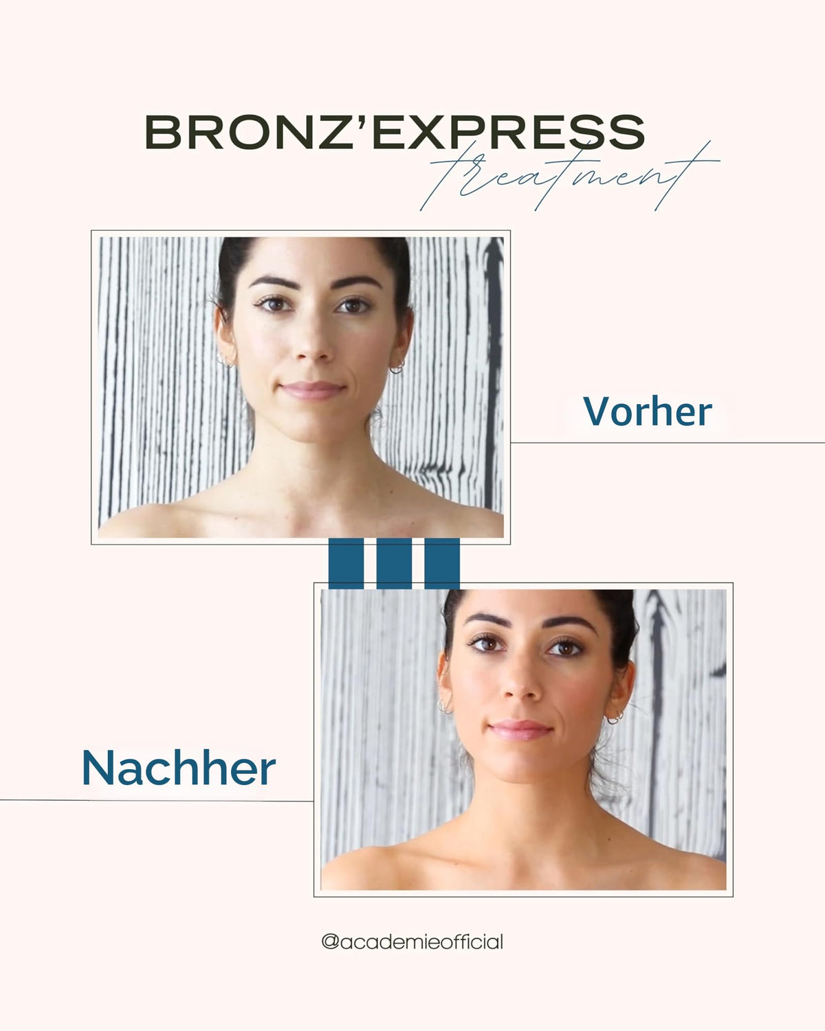 BRONZ EXPRESS | Selbstbräuner Gesicht und Körper Getönte | Lotion Natürliches Ergebnis | 150 Milliliter | Natürliche Bräune | Sofortige Gesunde Bräune | Französische Traditionsmarke Seit 1960